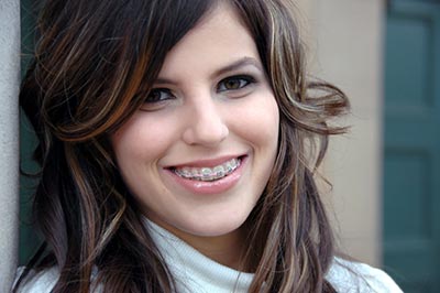 woman with braces smiling